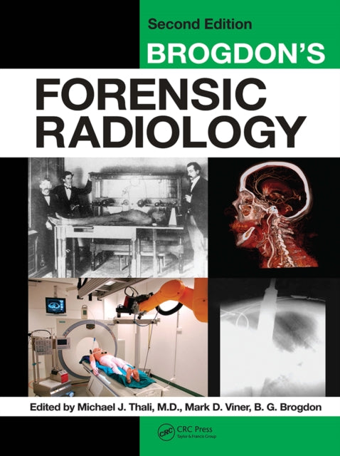 Book cover of: Brogdon's Forensic Radiology