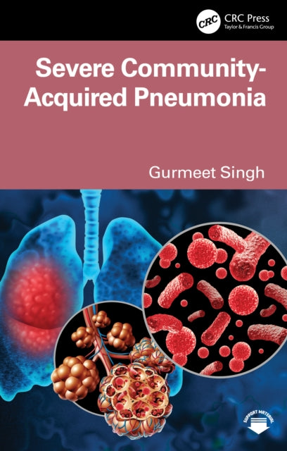 Book cover of: Severe Community Acquired Pneumonia
