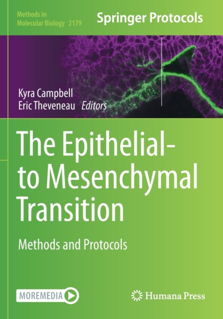 Book cover of: Epithelial-to Mesenchymal Transition. By: Kyra Campbell