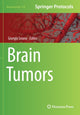 Book cover of: Brain Tumors. By: Giorgio Seano