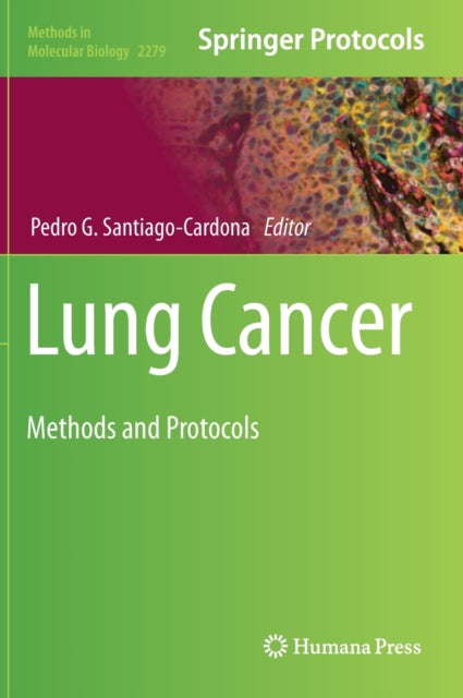 Book cover of: Lung Cancer. By: Pedro G. Santiago-Cardona