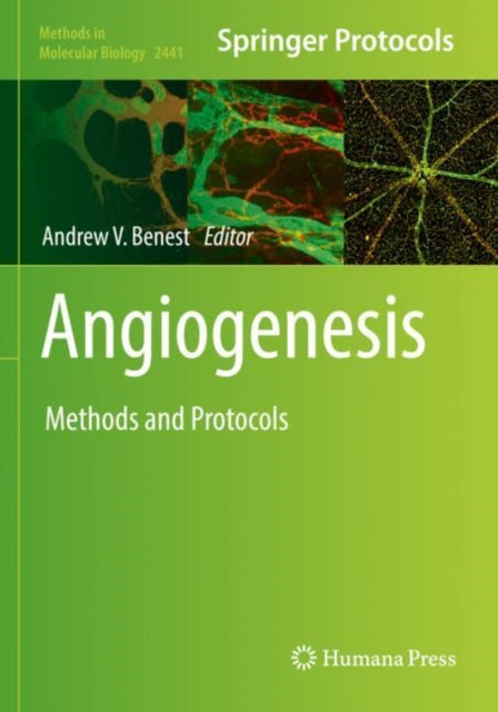 Book cover of: Angiogenesis. By: Andrew V. Benest