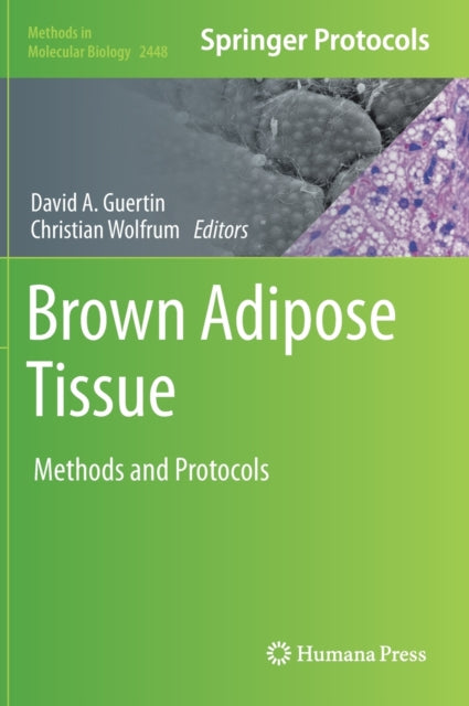 Brown Adipose Tissue