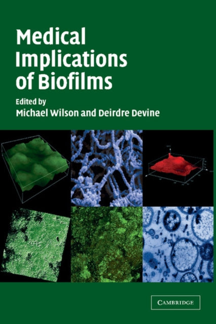 Book cover of: Medical Implications of Biofilms. By: Michael Wilson