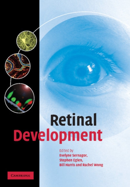 Book cover of: Retinal Development. By: Evelyne Sernagor