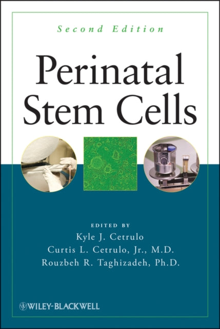 Book cover of: Perinatal Stem Cells. By: Kyle Cetrulo