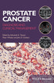 Book cover of: Prostate Cancer