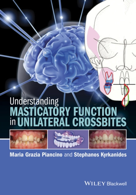 Book cover of: Understanding Masticatory Function in Unilateral Crossbites. By: Maria Grazia Piancino