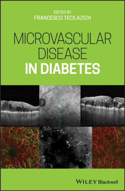 Book cover of: Microvascular Disease in Diabetes. By: Francesco Tecilazich