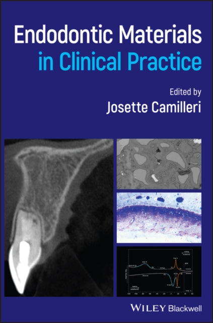 Book cover of: Endodontic Materials in Clinical Practice. By: Josette Camilleri