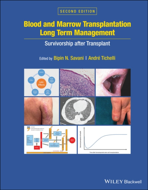 Book cover of: Blood and Marrow Transplantation Long Term Management. By: Bipin N. Savani