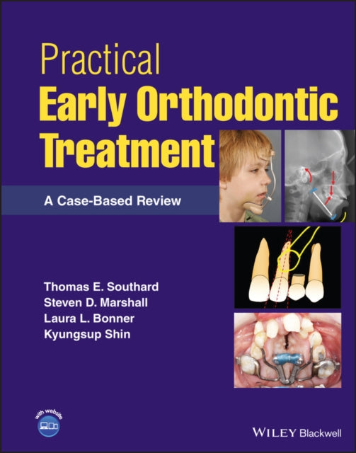 Book cover of: Practical Early Orthodontic Treatment. By: Thomas E. Southard