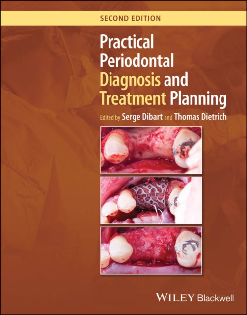 Book cover of: Practical Periodontal Diagnosis and Treatment Planning. By: Dibart