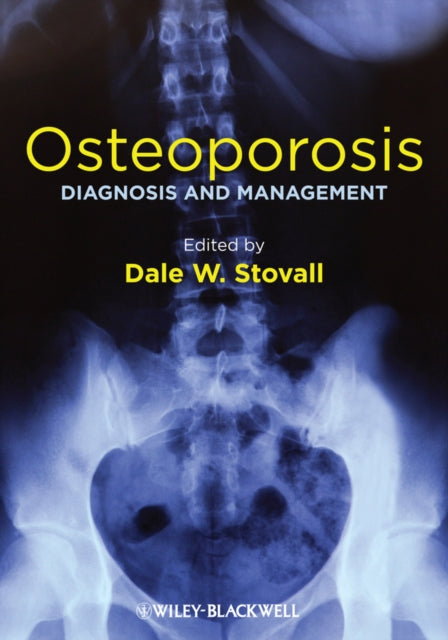 Book cover of: Osteoporosis. By: Dale W. Stovall