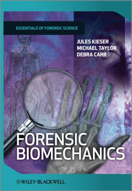 Book cover of: Forensic Biomechanics. By: Jules Kieser