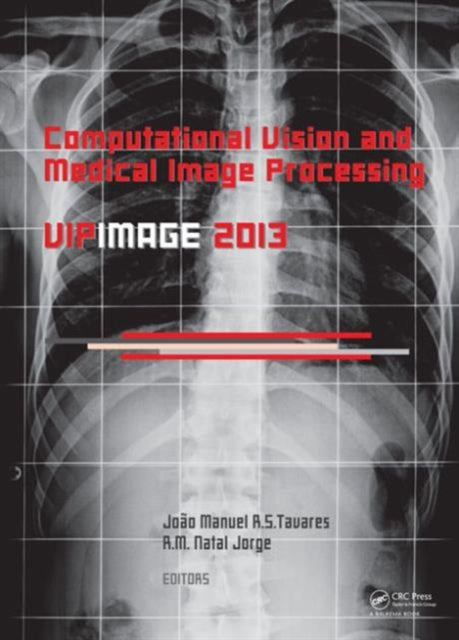 Book cover of: Computational Vision and Medical Image Processing IV. By: João Manuel R. S. Tavares