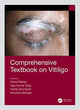 Book cover of: Comprehensive Textbook on Vitiligo. By: Vijay Kumar Garg