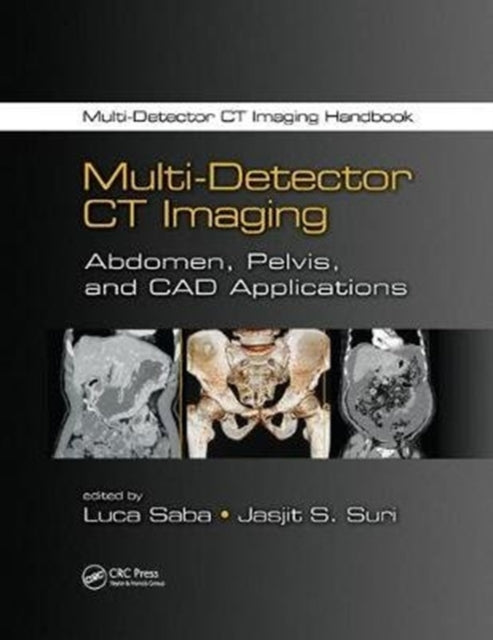 Book cover of: Multi-Detector CT Imaging. By: Luca Saba