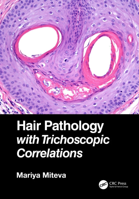 Book cover of: Hair Pathology with Trichoscopic Correlations. By: Mariya I. Miteva