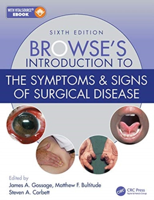 Book cover of: Browse's Introduction to the Symptoms & Signs of Surgical Disease. By: Steven A. Corbett
