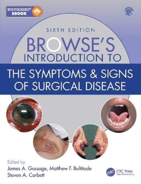 Book cover of: Browse's Introduction to the Symptoms & Signs of Surgical Disease. By: Steven A. Corbett