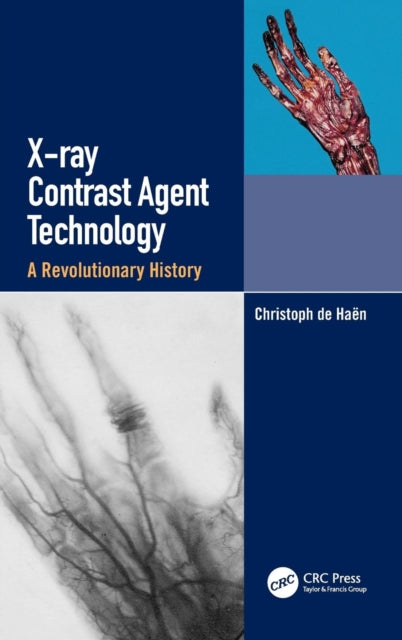 Book cover of: X-ray Contrast Agent Technology. By: Christoph de Haen