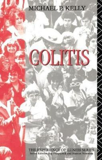 Colitis