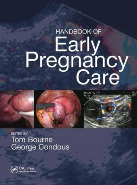 Book cover of: Handbook of Early Pregnancy Care. By: Thomas H. Bourne