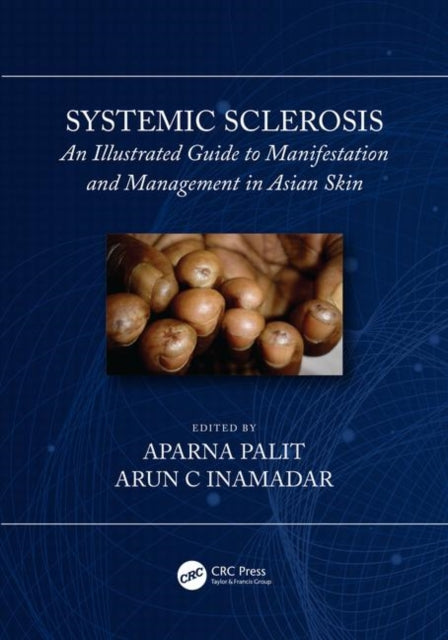 Book cover of: Systemic Sclerosis. By: Arun C. Inamadar