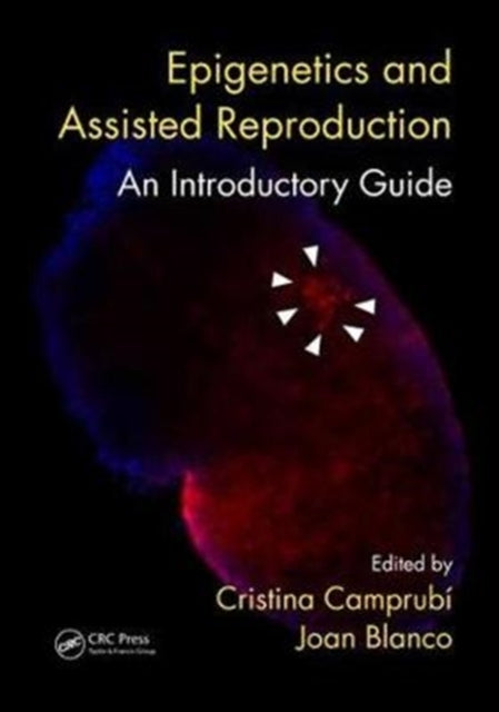 Book cover of: Epigenetics and Assisted Reproduction. By: Cristina Camprubí