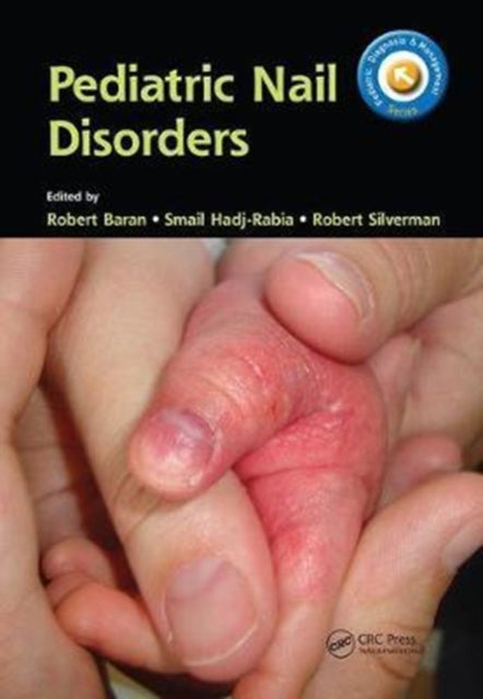Book cover of: Pediatric Nail Disorders. By: Robert Baran