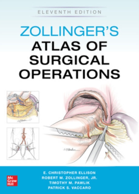 Book cover of: Zollinger's Atlas of Surgical Operations, Eleventh Edition. By: Zollinger, Robert M., Sr.
