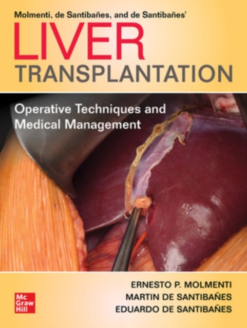 Book cover of: Liver Transplantation: Operative Techniques and Medical Management. By: Ernesto P. Molmenti