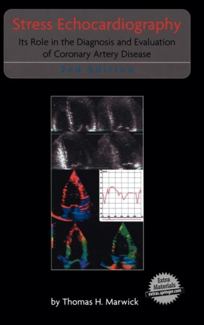 Book cover of: Stress Echocardiography. By: T.H. Marwick