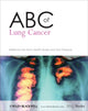 Book cover of: ABC of Lung Cancer. By: Ian Hunt