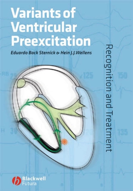 Book cover of: Variants of Ventricular Preexcitation. By: Eduardo Sternick