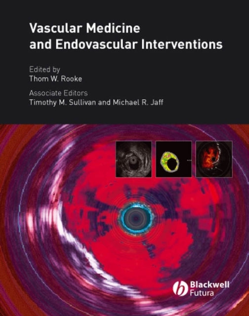 Book cover of: Vascular Medicine and Endovascular Interventions. By: Thom Rooke