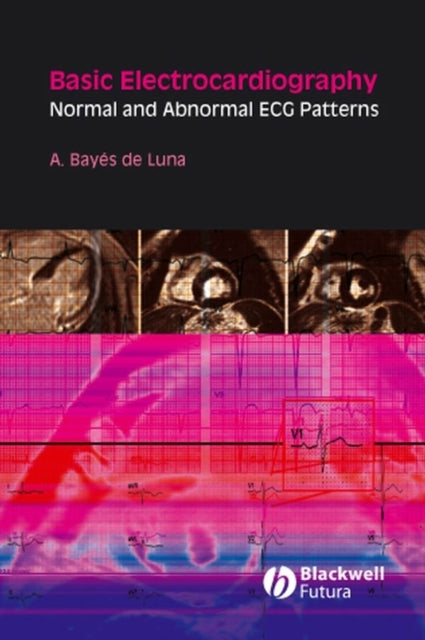 Book cover of: Basic Electrocardiography. By: Antonio Bayés de Luna, Antoni Bayés de Luna