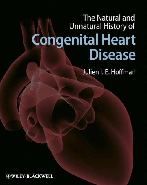 Book cover of: Natural and Unnatural History of Congenital Heart Disease. By: Julien I. E. Hoffman