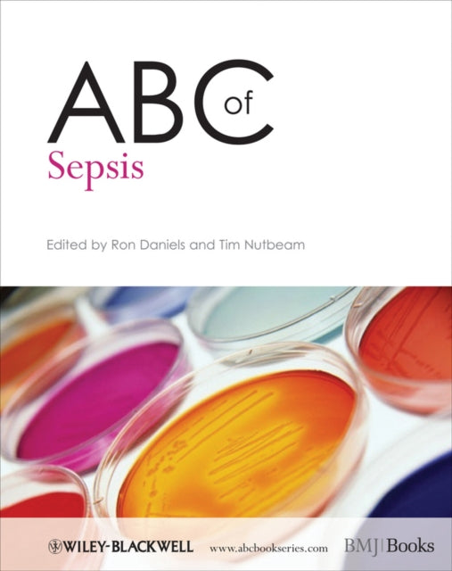 Book cover of: ABC of Sepsis