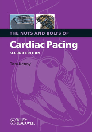 The Nuts and Bolts of Cardiac Pacing