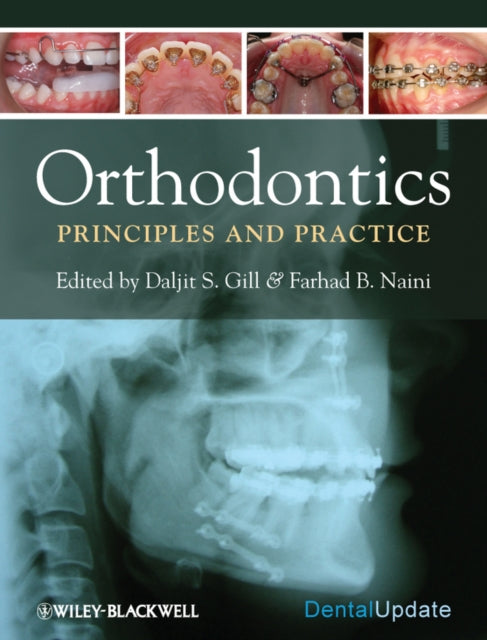 Book cover of: Orthodontics. By: Daljit S. Gill