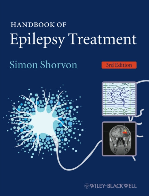 Book cover of: Handbook of Epilepsy Treatment. By: S. D. Shorvon