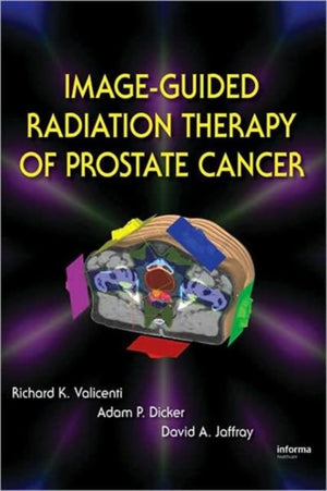 Image-Guided Radiation Therapy of Prostate Cancer