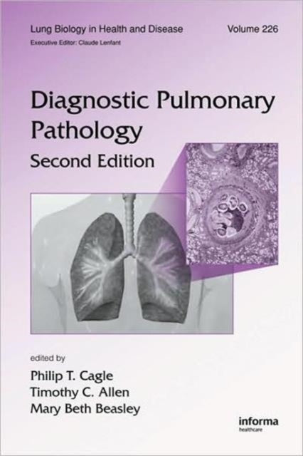 Book cover of: Diagnostic Pulmonary Pathology