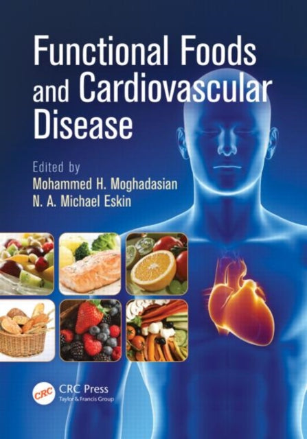 Book cover of: Functional Foods and Cardiovascular Disease