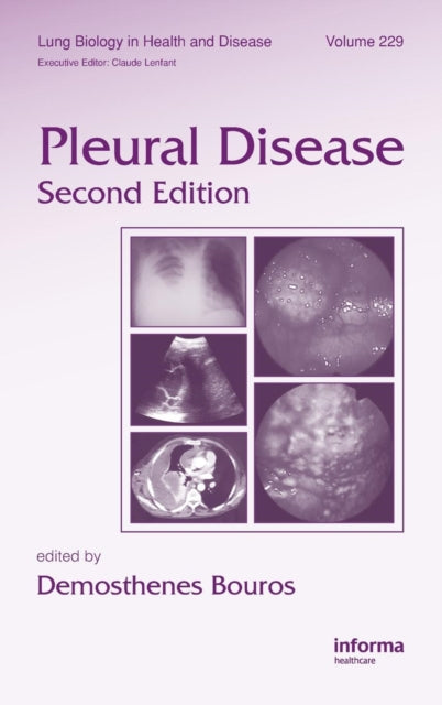Book cover of: Pleural Disease