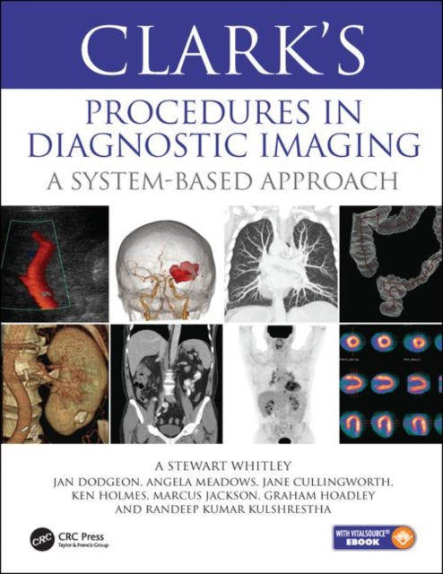 Book cover of: Clark’s Procedures in Diagnostic Imaging. By: M. Stanley Whitley