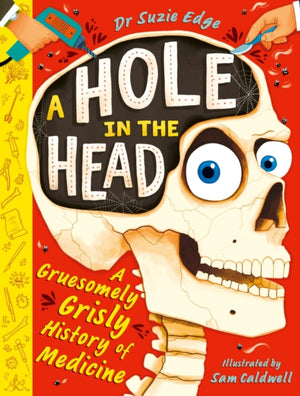Hole in the Head, A gruesomely grisly history of medical firsts