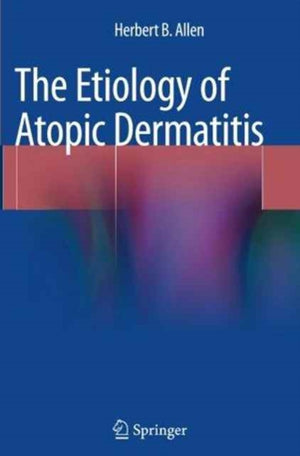 Etiology of Atopic Dermatitis